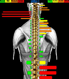Chiropractic-Independence-MO-Digital-Infrared-Scan Chiropractic Independence MO Digital Infrared Scan